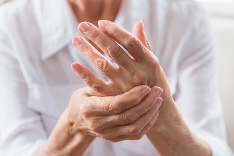 Hands affected by arthritis